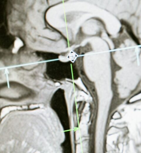 13 Popular Flu Season Myths: Fact or Fiction?