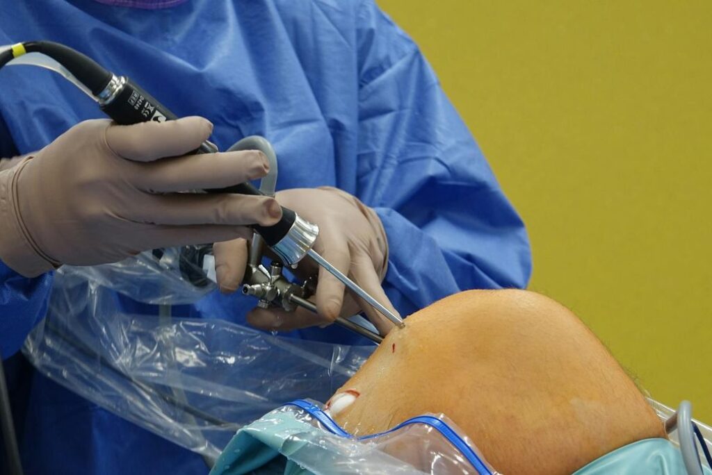 Top 10 Orthopedic Surgeons in Chennai 2026: Bone & Joint Experts