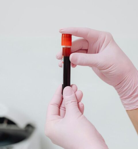 🌟 Your Ultimate Guide to Finding the Best Dermatologist in Chennai: Top Doctors, FAQs, and Essential Tips